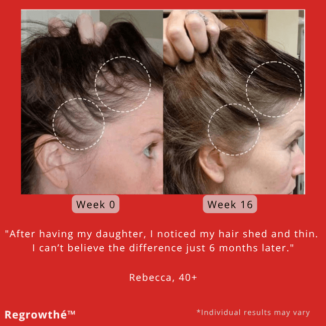 Regrowthé™ - 3 in 1 restorative scalp massager