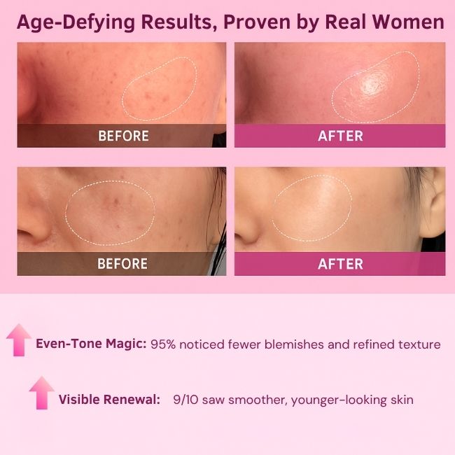 Plumpé™ – Anti-Aging Collagen Face Cream (100ml)