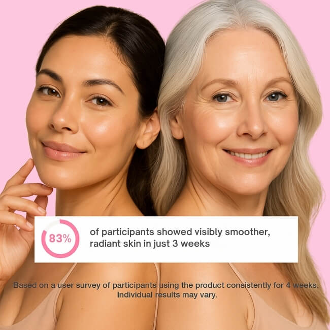 Plumpé™ – Anti-Aging Collagen Face Cream (100ml)