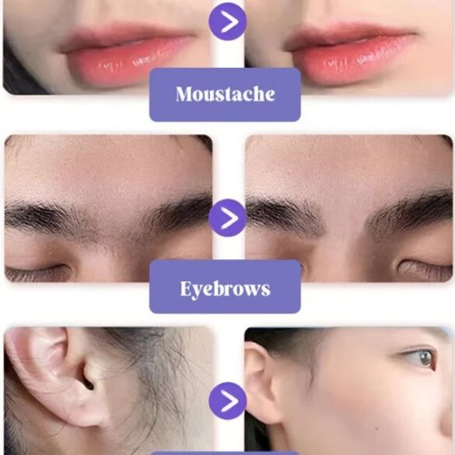 Smoothé™ - Facial Hair Removal Cream