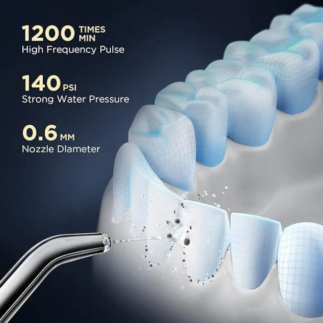 SmileGuard Pro™ - Advanced Portable Water Flosser