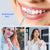 SmileGuard Pro™ - Advanced Portable Water Flosser