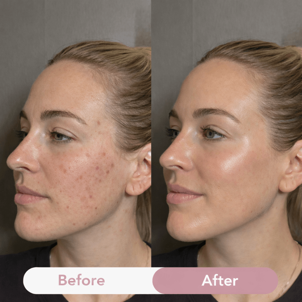 Plumpé™ – Anti-Aging Collagen Face Cream (100ml)